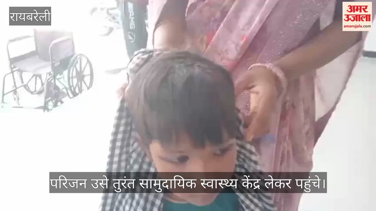 VIDEO: आंगन में सो रही मासूम कों बंदर ने काटा, गंभीर