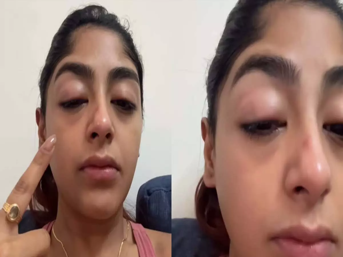 स्प्लिट्सविला X16 की प्रीत सिंह ने मुंबई के क्लब में हमले का आरोप, सूजी आंखों का वीडियो साझा किया