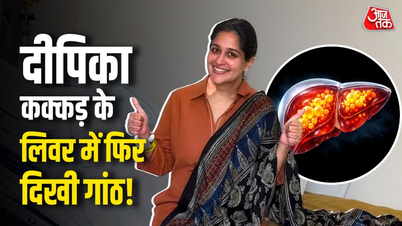 दीपिका कक्कड़ के लिवर में दिखी 1.3 cm की गांठ, क्या कैंसर का संकेत?