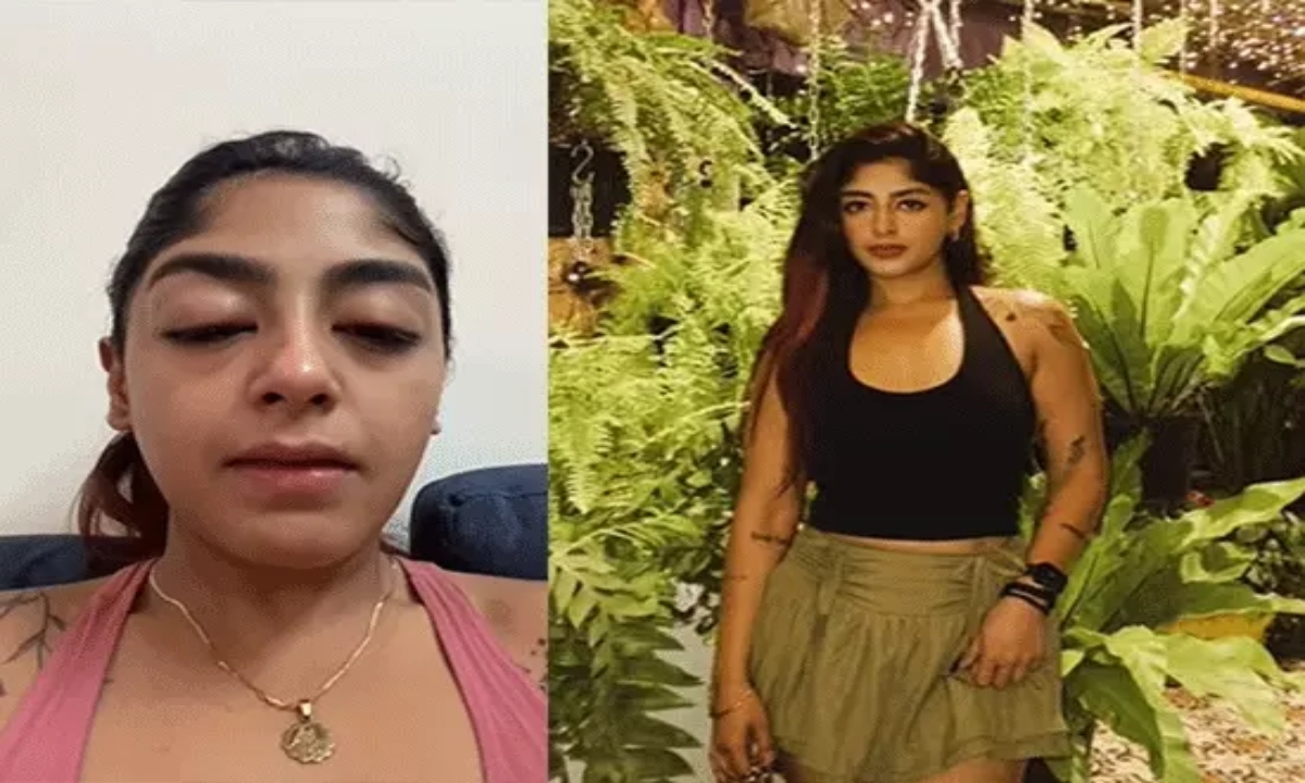स्प्लिट्सविला कंटेस्टेंट प्रीत सिंह के साथ मारपीट का दावा: दांत टूटा, आंखों में सूजन